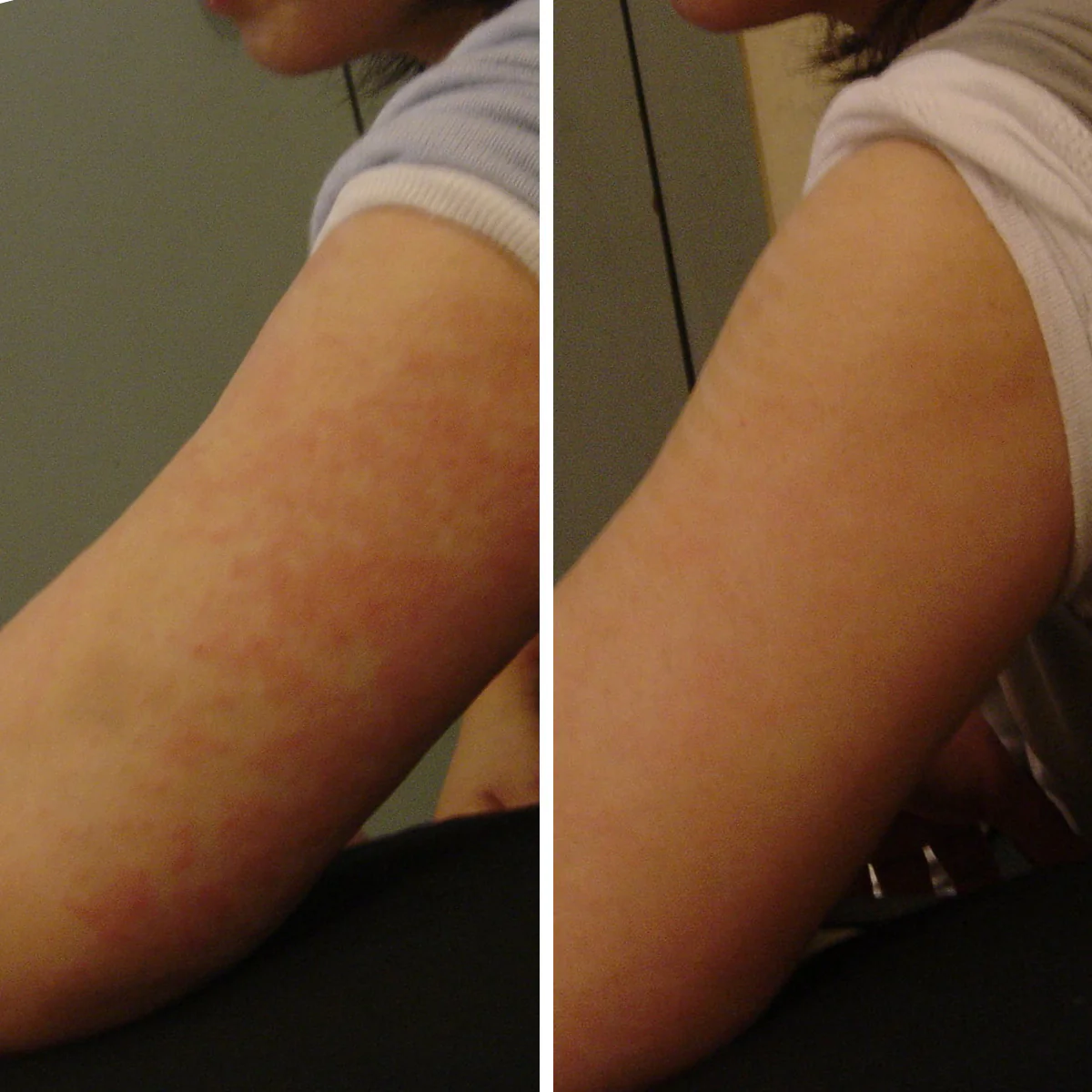 Sucha skóra: koniec z dyskomfortem – sekrety głębokiego nawilżenia i regeneracji