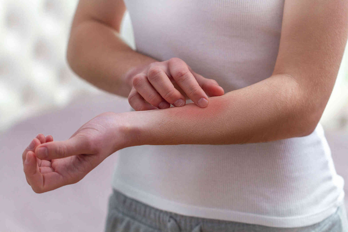 Egzema czy alergia kontaktowa? Jak sprawdzić, co podrażnia Twoją skórę