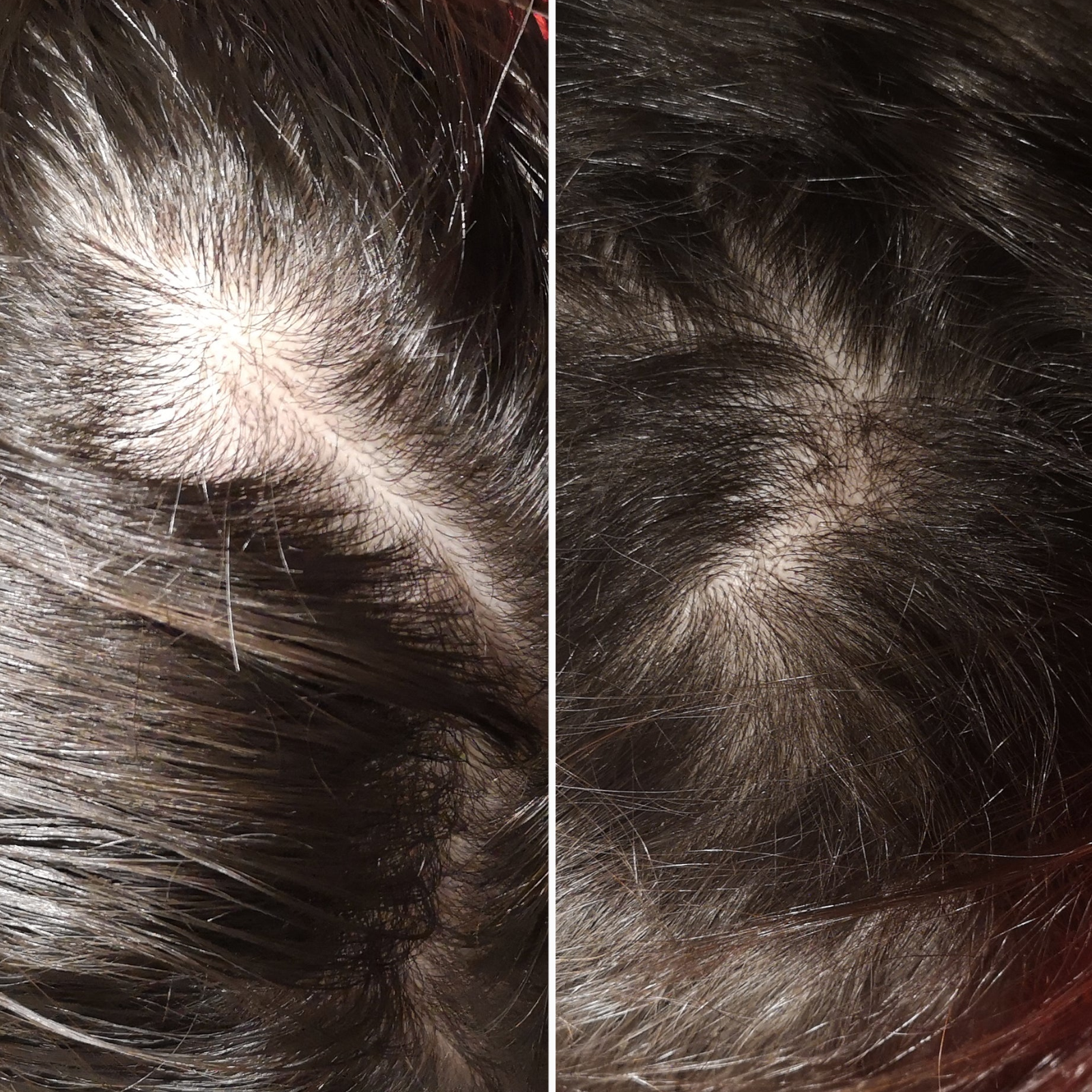 4-Stopniowy Zestaw HairLXR + Szczotka do Masażu