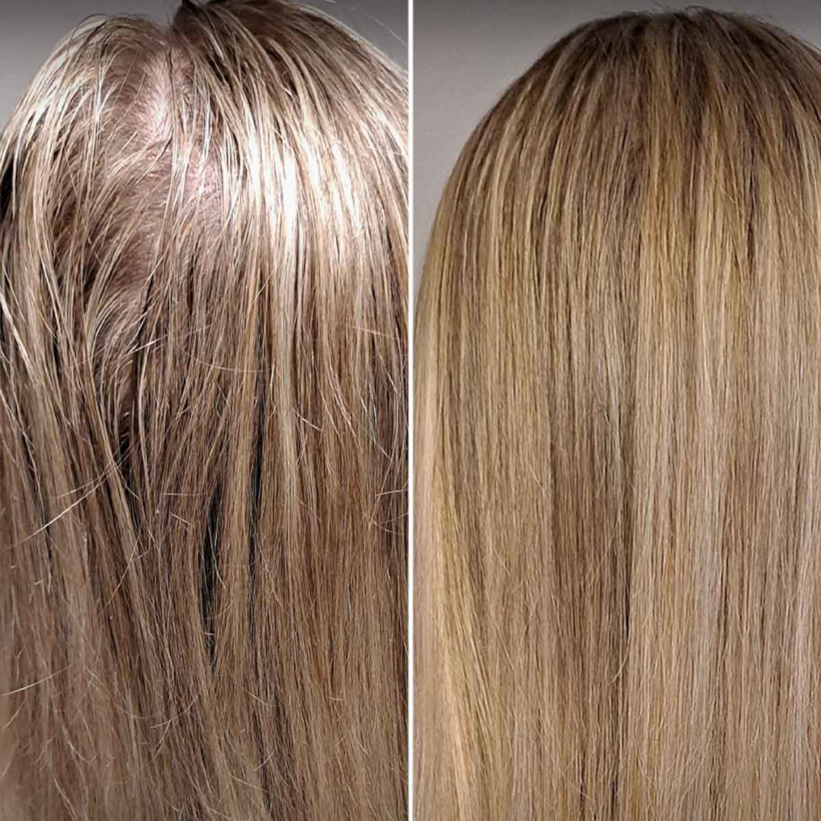 4-Stopniowy Zestaw HairLXR