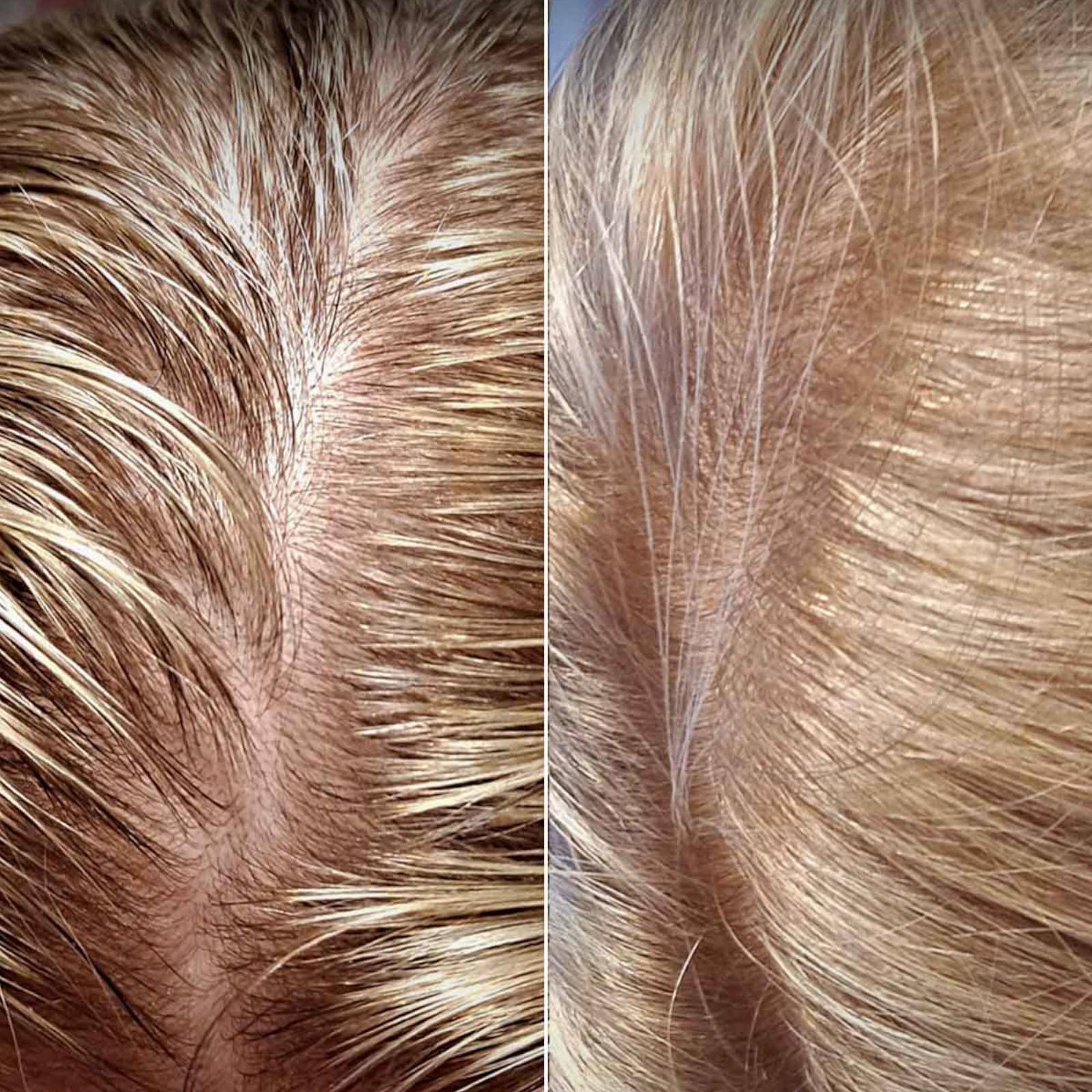 4-Stopniowy Zestaw HairLXR + Szczotka do Masażu
