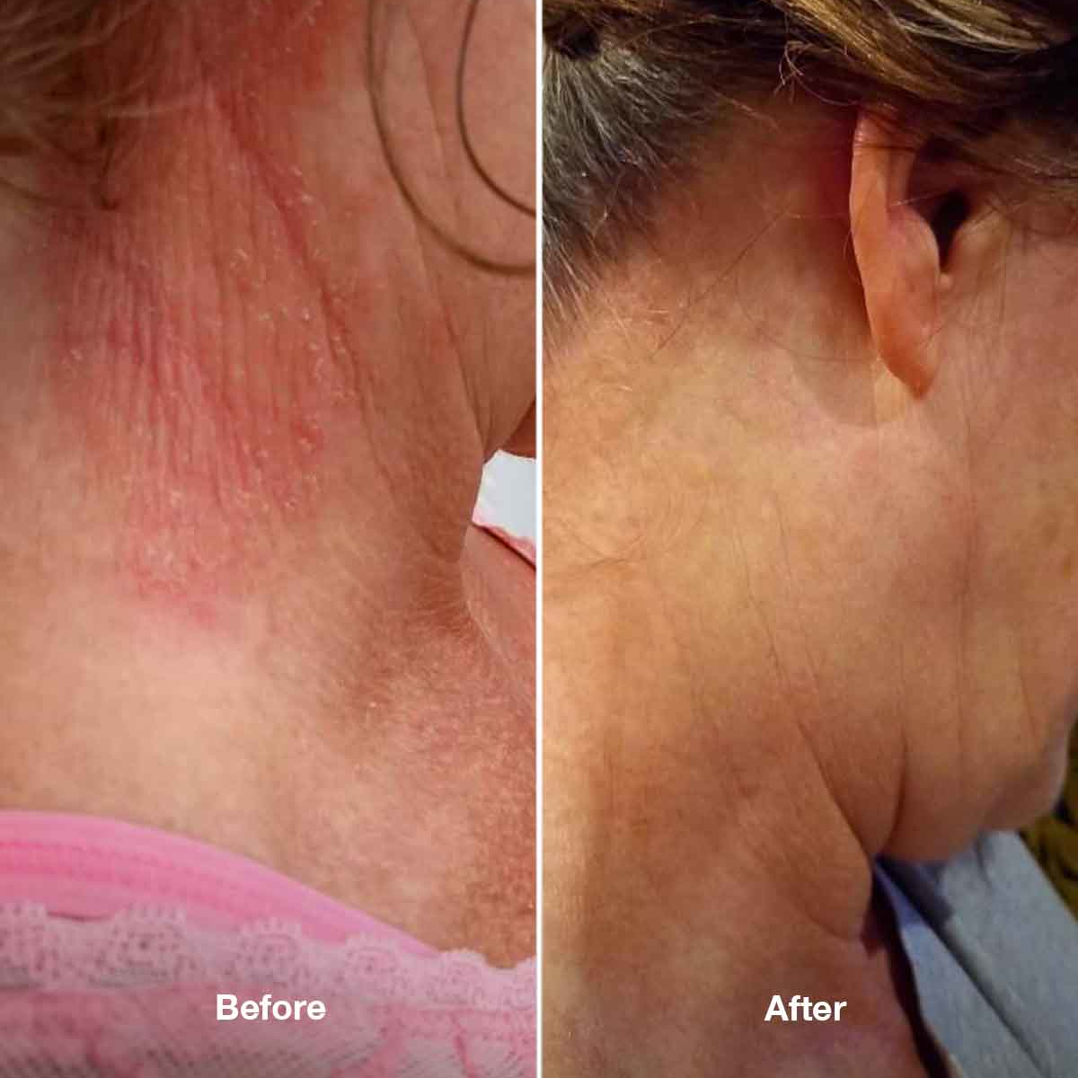 Zestaw Healpsorin No. 3