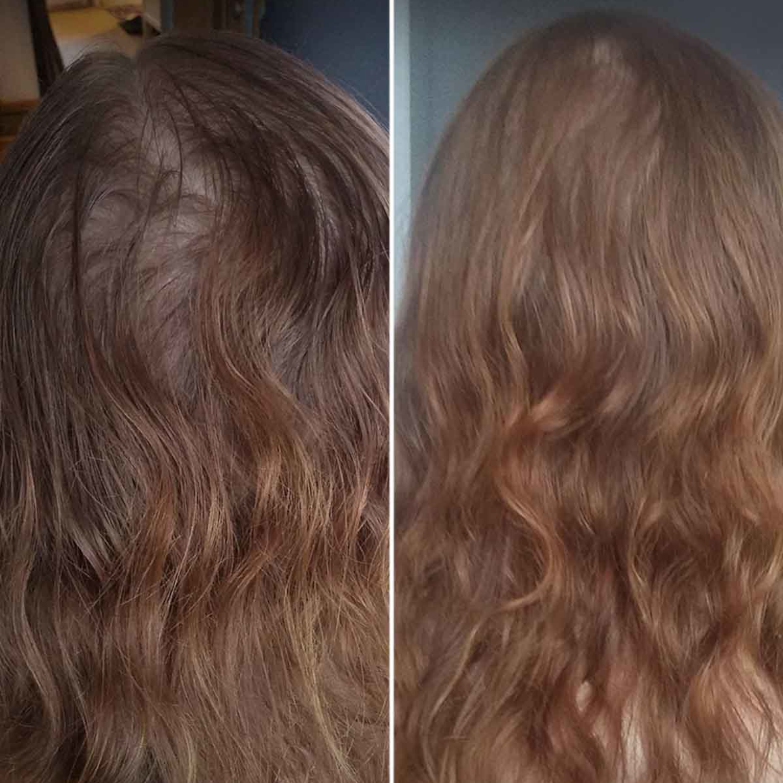 4-Stopniowy Zestaw HairLXR + Szczotka do Masażu